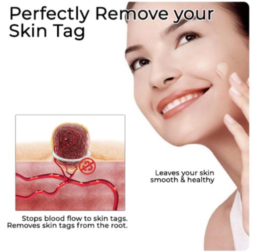Tag-Clear Pro Kit®