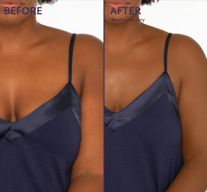 Body Perfector